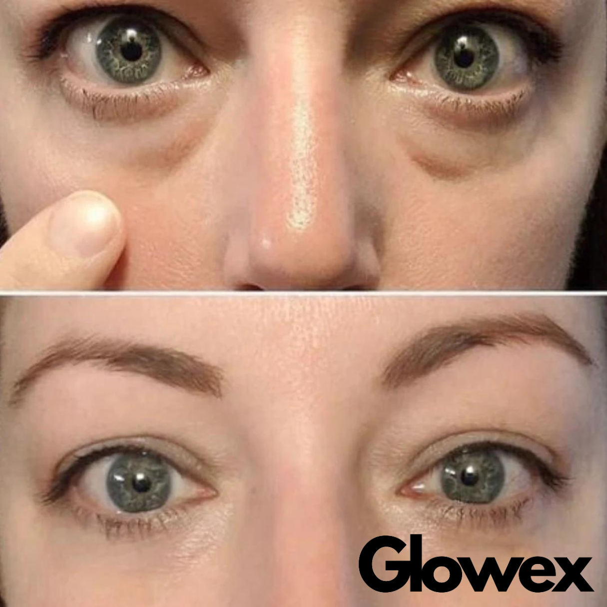 Eye-Glow Pro - Glowex | Acne-Vanish Pro, light therapy. Say Goodbye To Acne: Shop Glowex